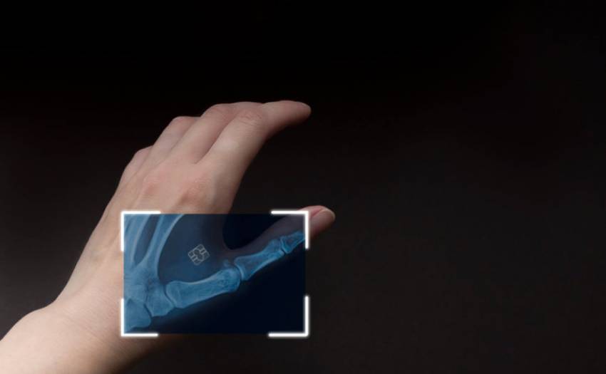 Certificatul Verde COVID pe microcipul implantat în mână