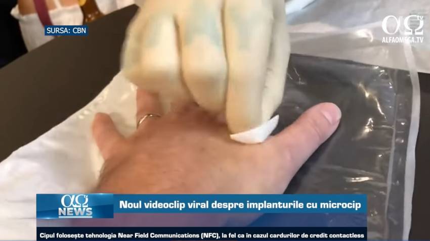 Implanturile cu microcip | AO NEWS, 22 decembrie 2021